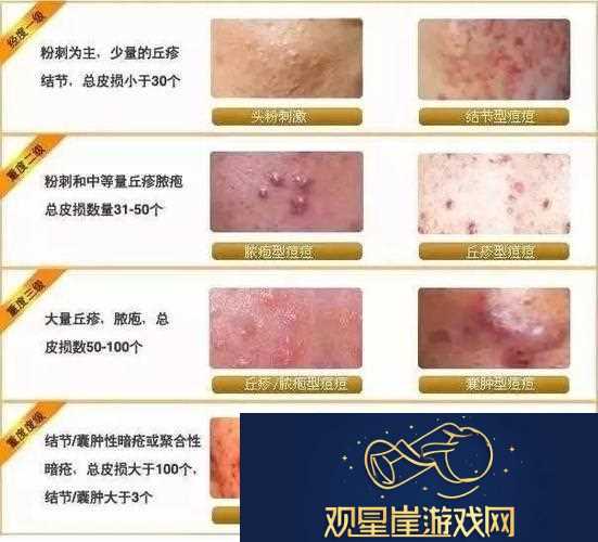 女性三角毛毛区长了个硬疙瘩